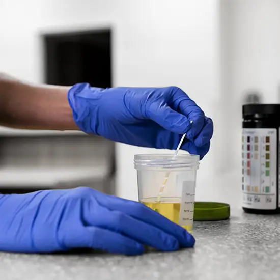 cocaine metabolite screen, urine test